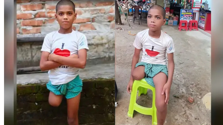 চুল কাটতে বের হওয়া রায়হান ফিরল এক পা হারিয়ে